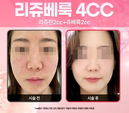 %255BPC%255D26%25EB%2585%2584%25EB%25A6%25AC%25EC%25A5%25AC%25EB%25B2%25A0%25EB%25A3%25A9.jpg